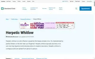 Whitlow's on U Street website