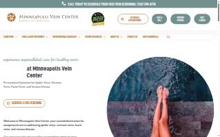Minneapolis Vein Center