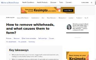 Whitehead Construction Group