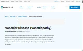 Vascular Surgery - Covington - St. Elizabeth Physicians