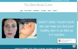 Tru Skin Acne Clinic