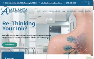 Atlanta Tattoo Removal