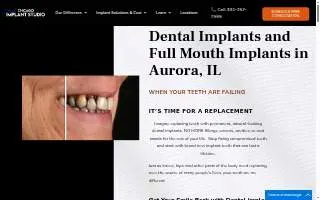 Chicago Implant Studio website