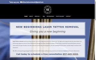 New Beginnings Laser Tattoo Removal