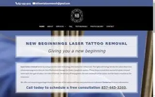 New Beginnings Laser Tattoo Removal website