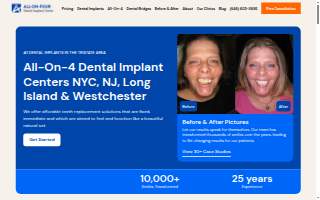 All On Four Dental Implants New Jersey