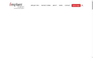 Implant Dental - Dr. Kurt W Kline