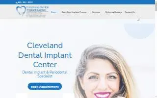 Cleveland Dental Implant Center website