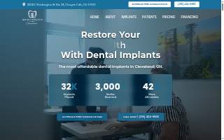 All On Implants Cleveland