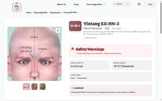 Yintang Acupuncture