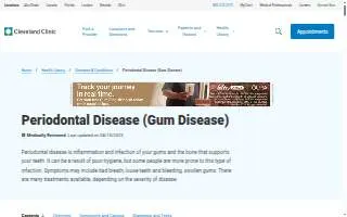 Periodontal Specialists of Indiana PSI website