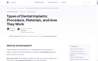 Implant Dentistry and Periodontics - Indianapolis